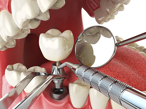 Best Emergency Dental Care for Trauma or Injury in Booneville, AR